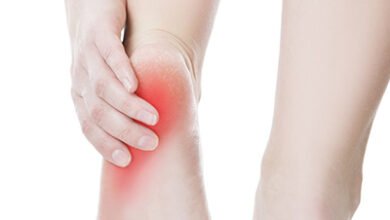 في يوم علاج الأرجل العالمي، تعرف على الأمراض التي تصيب الأرجل