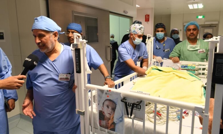 نجاح فصل التوأم السيامي العراقي "عمر وعلي" بعد عملية جراحية معقدة استغرقت 11 ساعة