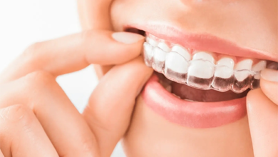 التقويم الشفاف