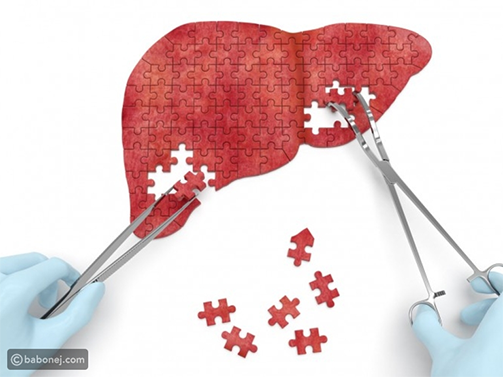 الفرق بين تليف الكبد وتشمع الكبد