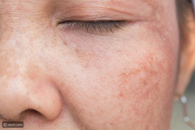 البودرة المائية الفوائد والأضرار